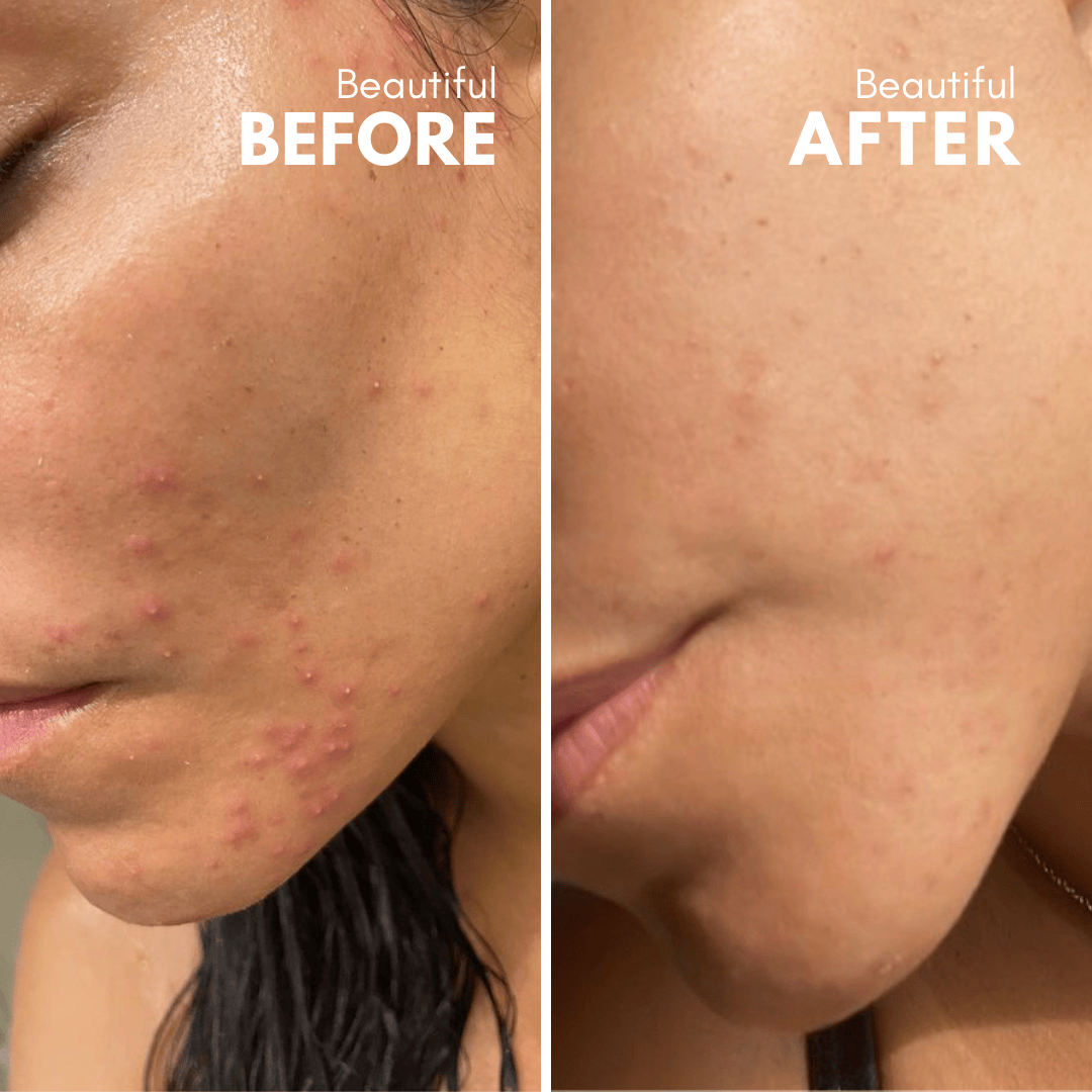 Apokathario | Natural Exfoliator